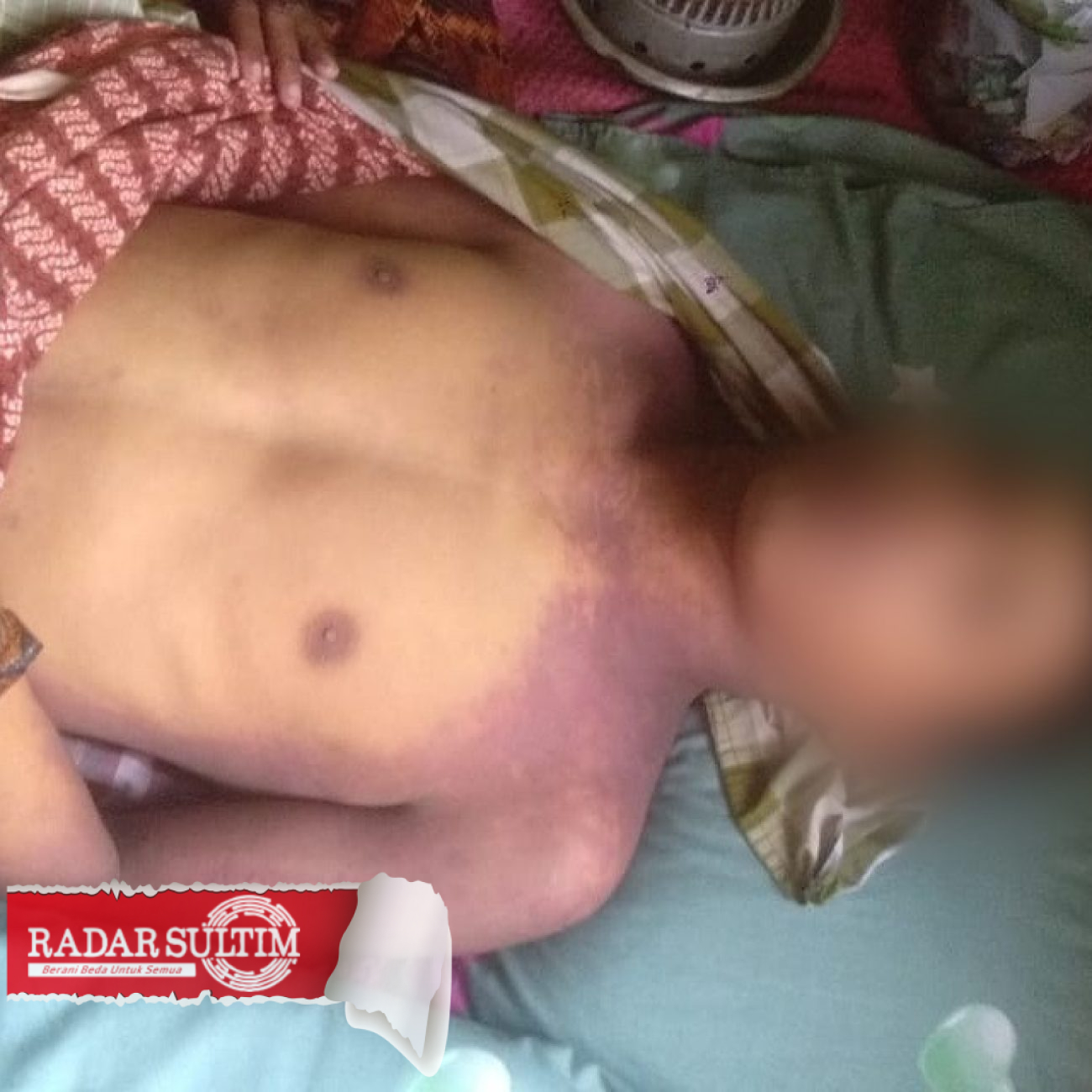 Badan Penuh Memar, Kematian Riki Dinilai Janggal, Keluarga Upaya Lapor Polisi