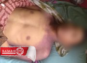 Badan Penuh Memar, Kematian Riki Dinilai Janggal, Keluarga Upaya Lapor Polisi